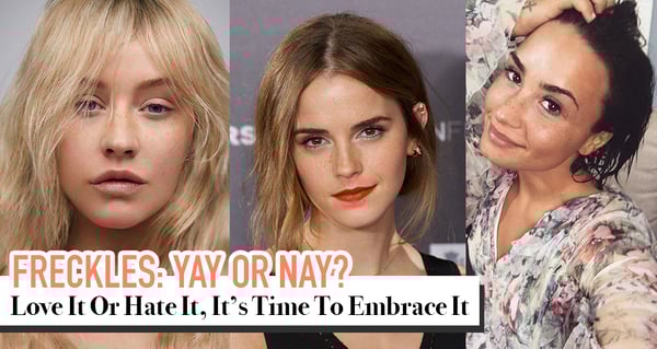 8 Celebrities Who Showed Us That Freckles Are Worth Embracing