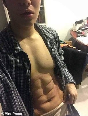 12865710-6972501-Scars_appear_visible_on_Mr_Ounvilai_abs_during_his_recovery_Mr_O-a-47_1556552456757