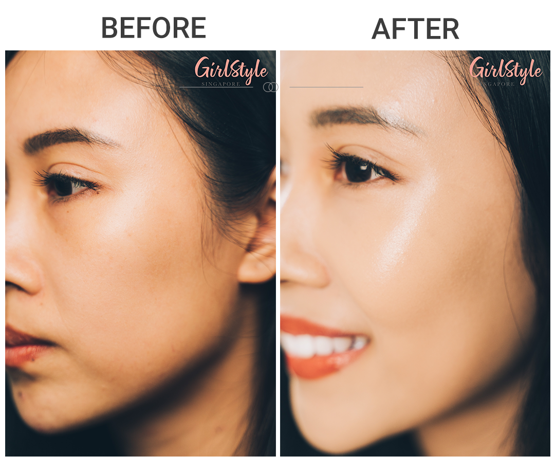 before and after using Troiareuke H+ Cushion