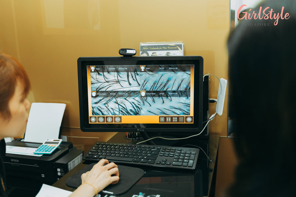 Jonsson Protein VE (Vital Essential) Protein® treatment scan