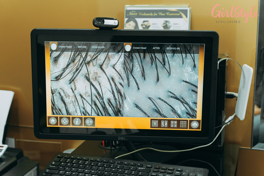 Jonsson Protein VE (Vital Essential) Protein® treatment scan