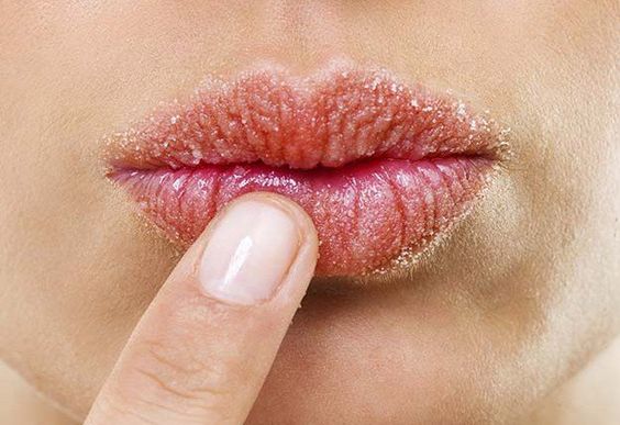 Exfoliate lips