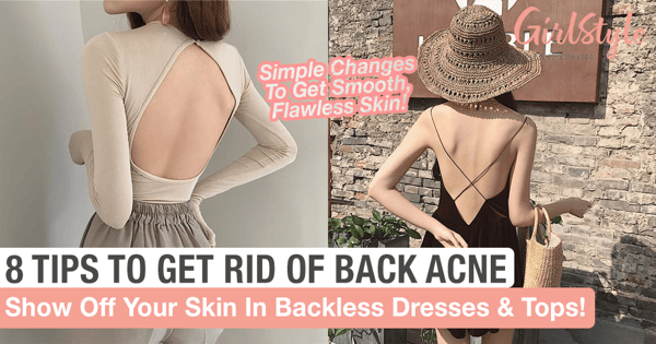 8 Simple Tips To Get Rid Of Back Acne Once And For All