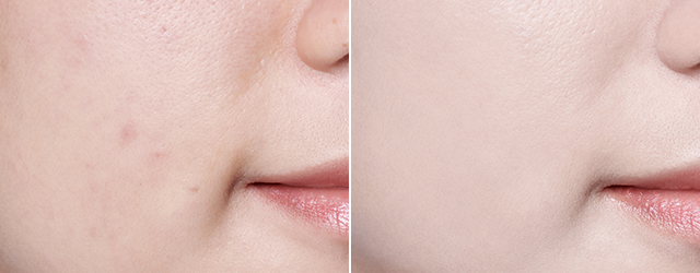 Neo Cushion matte covers blemishes