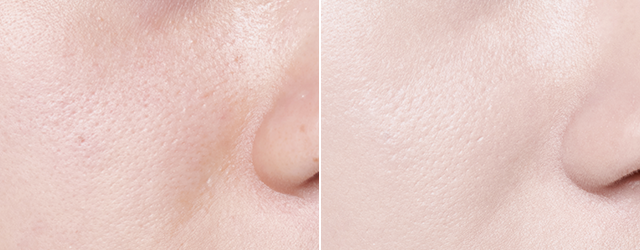 Neo Cushion matte covers pores