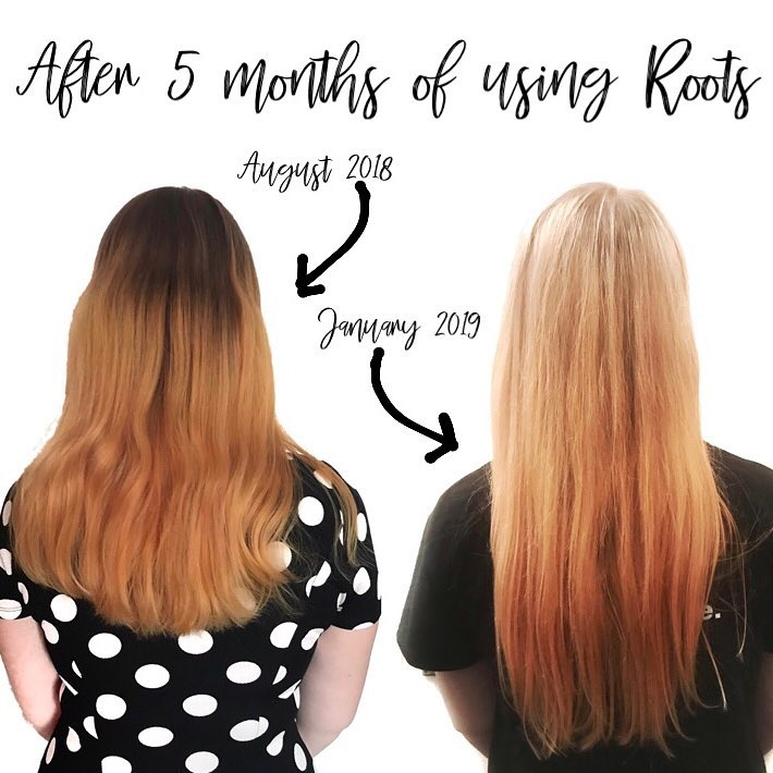 Hair care mistakes hair loss frizzy hair