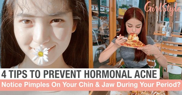 4 Tips To Prevent Hormonal Acne From Popping Up During That Time Of The Month