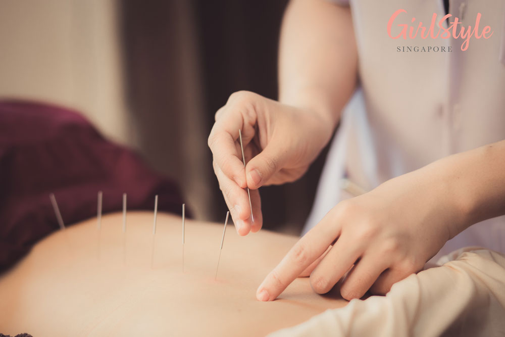 traditional chinese medicine acupuncture