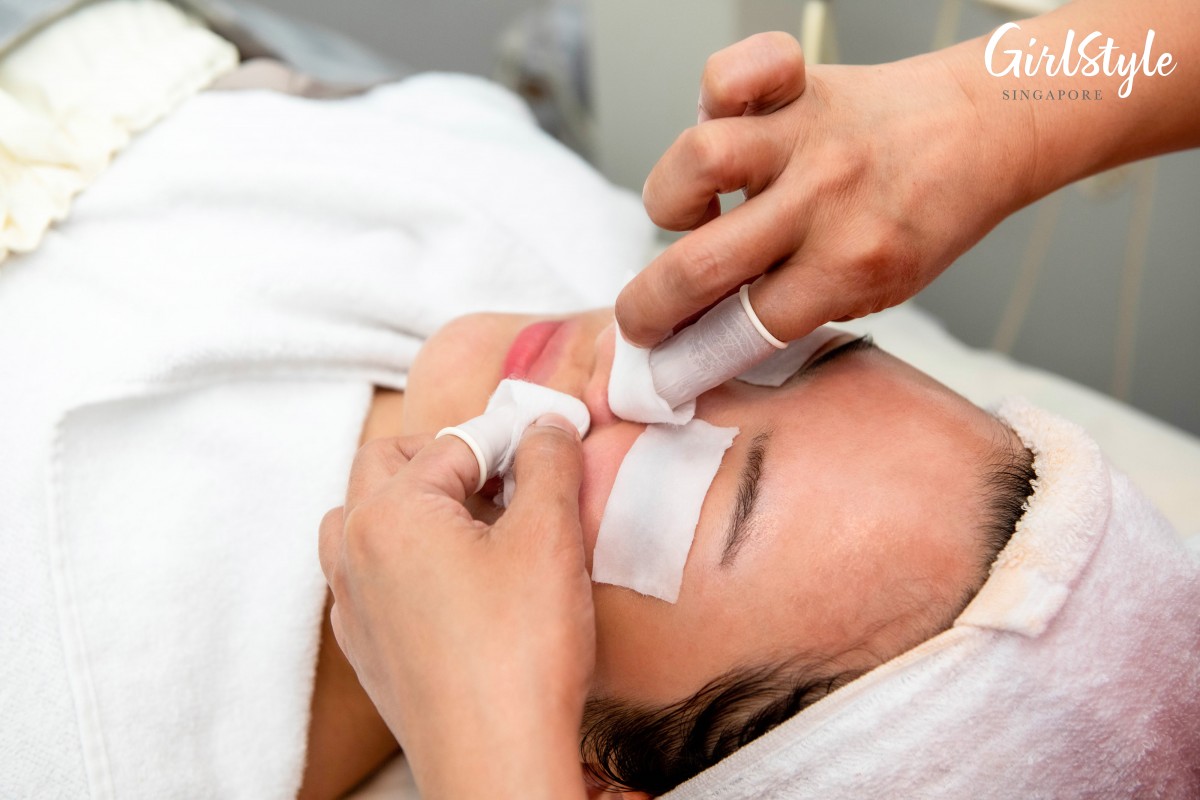 AsterSpring extraction during treatment