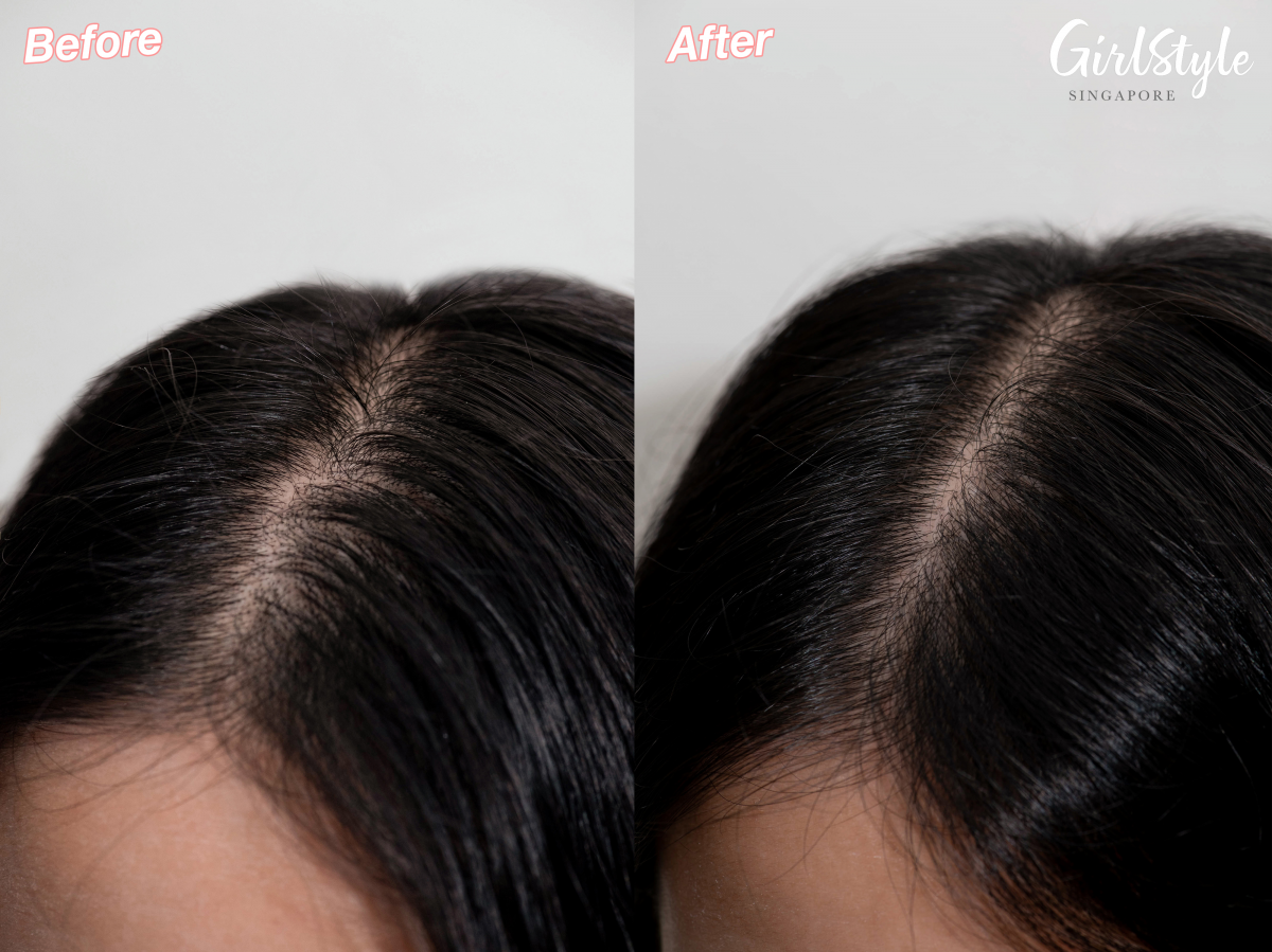 scalp comparison after using ellure tomato shampoo