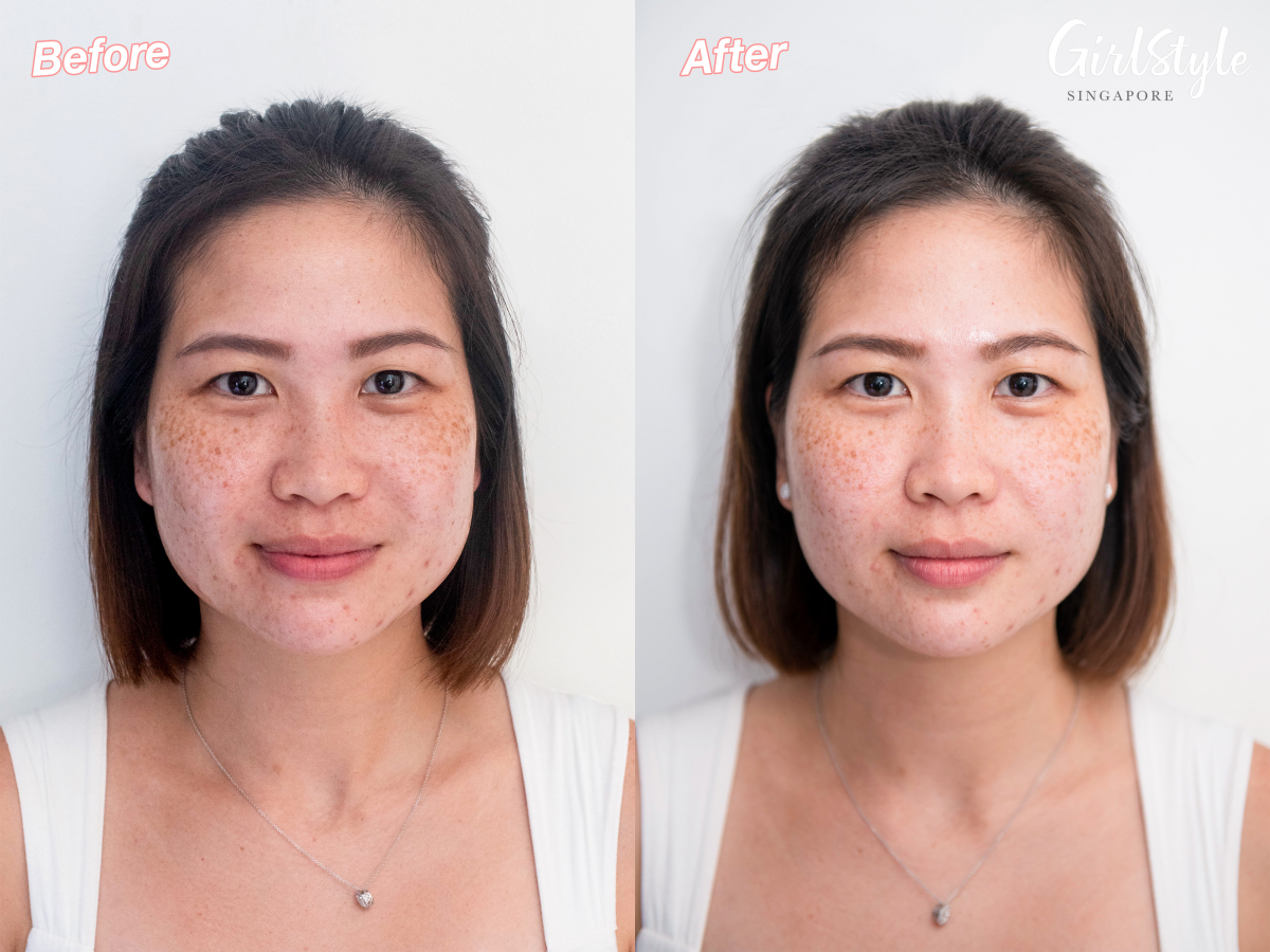 complexion comparison after using ellure tomato face mask