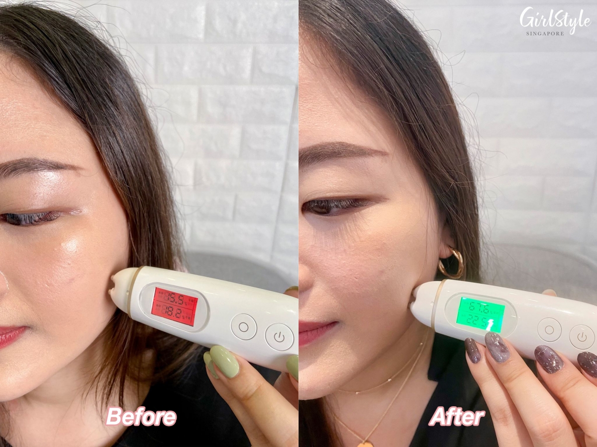Before and after drinking Hao Yi Kang Lao Xie Zhen Collagen Beauty Essence