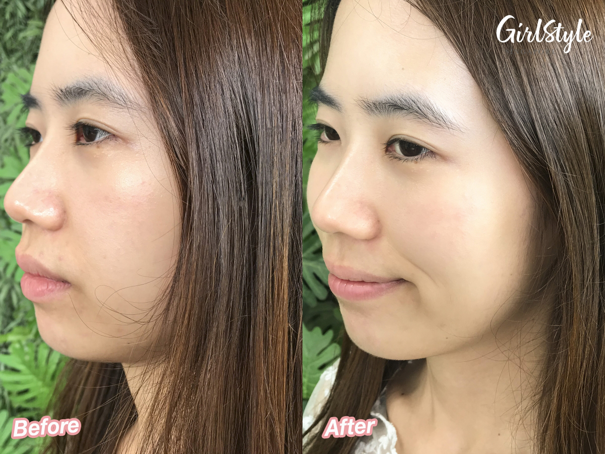 skin before after using thefaceshop yehwadam moisturising products
