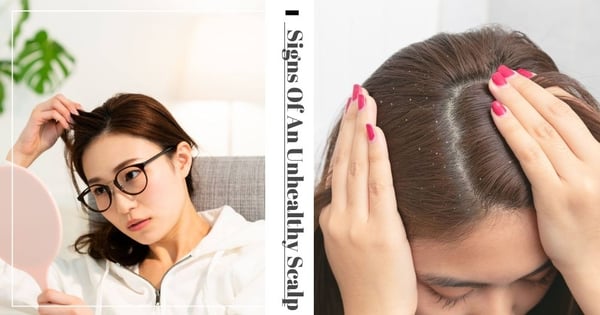 3 Most Common Signs Of An Unhealthy Scalp & How This Treatment Improved My Scalp Woes