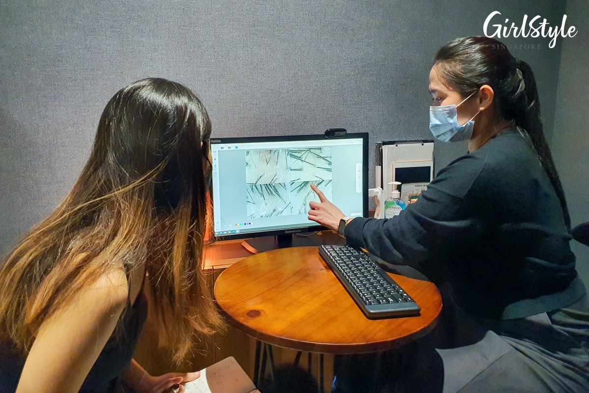 Scalp Analysis PHS Hairscience_2_1