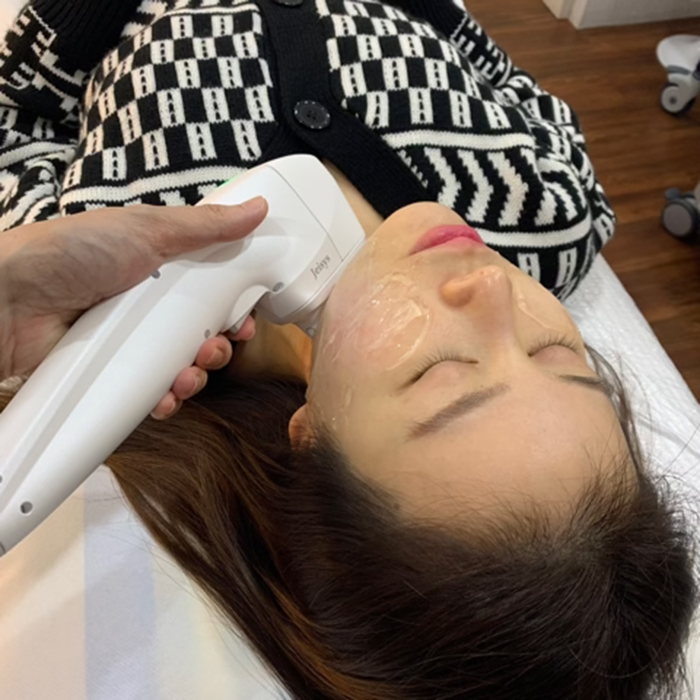 HIFU treatment Singapore Kowayo review_Double chin