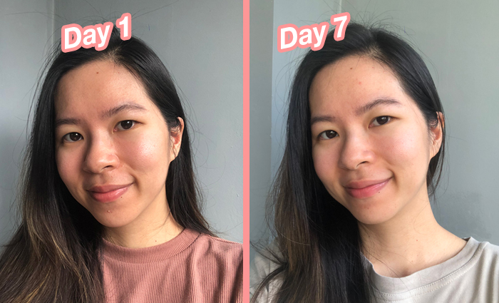 osim-uglow-beauty-devices_before after 1