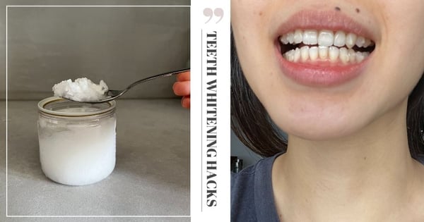 I Tried 4 Teeth Whitening Hacks, And Here’s What Really Worked