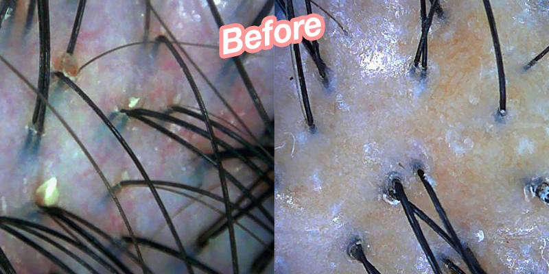 Karmen’s scalp scan before the treatment. 