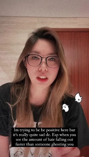 Nina Tan hair loss balding