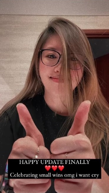 Nina Tan hair loss balding