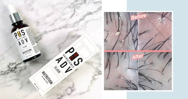 I Used A Scalp Exfoliator For 2 Weeks And Here’s The Difference It Made To My Scalp & Hair