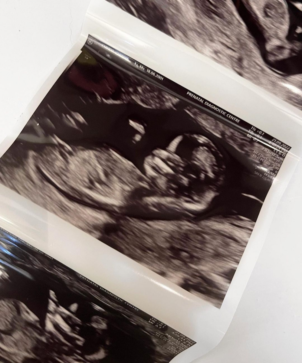 Titus Low's wife Cheryl Chin is pregnant