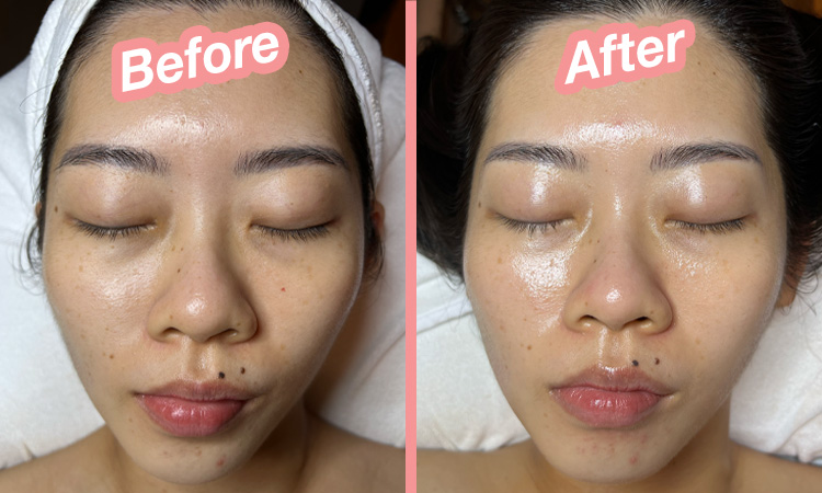 Nap & Glow Hydra-Snowflake Treatment review.