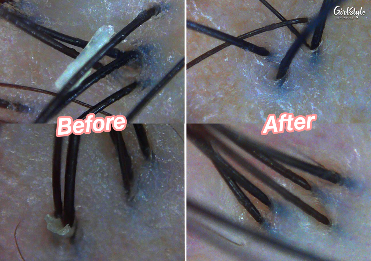 The post-treatment scan revealed a cleaner and healthier-looking scalp.