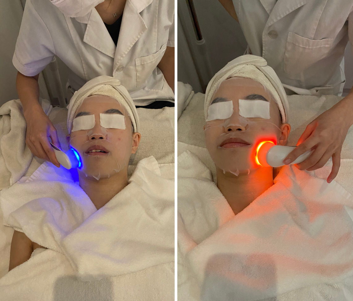 Blue LED was first used to soothe and alleviate Xiaojie’s acne, followed by orange LED to help lighten dark spots and bring a glow to her complexion.