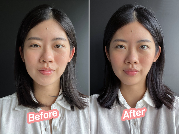 After just one session, Sophie’s visage was visibly lifted, slimmer and more symmetrical.