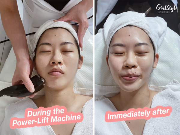 The Power-Lift machine emits gentle electromagnetic heat waves to activate collagen regeneration and skin cell renewal.