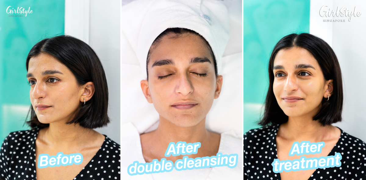 After just one session, my complexion looked visibly brighter, plumper, and more radiant.