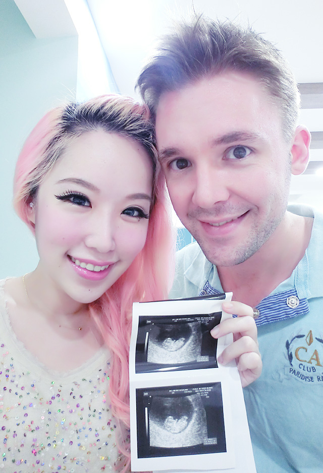 Xiaxue and Mike with Dash's ultrasound