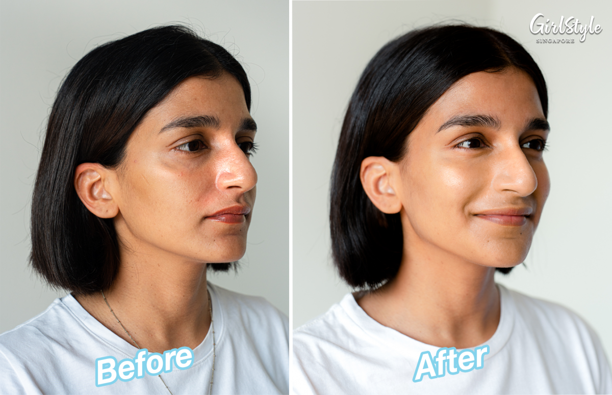 Before, Shairah had visibly oily patches on her t-zone. But after two weeks of trying out the Hydro Boost Hyaluronic Acid Serum, her skin looks smoother, plumper (especially around her under eye area) and more even-toned.