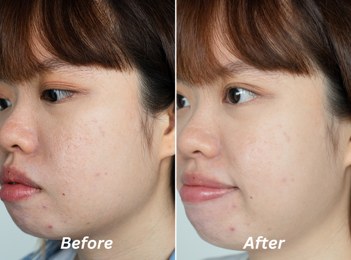 Samantha's skin before and after two weeks of testing.