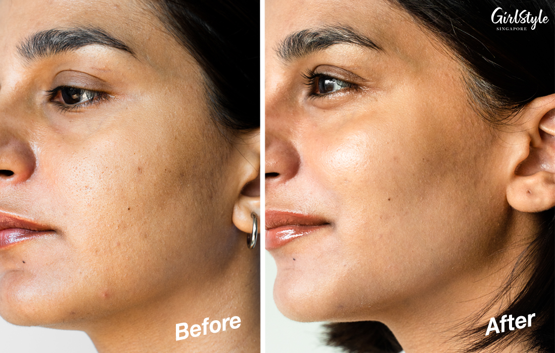 In two weeks, the Advanced Light Ceramide Capsules Strengthening & Refining Serum has improved my skin texture – visibly reducing the roughness and enlarged pores on my cheeks.