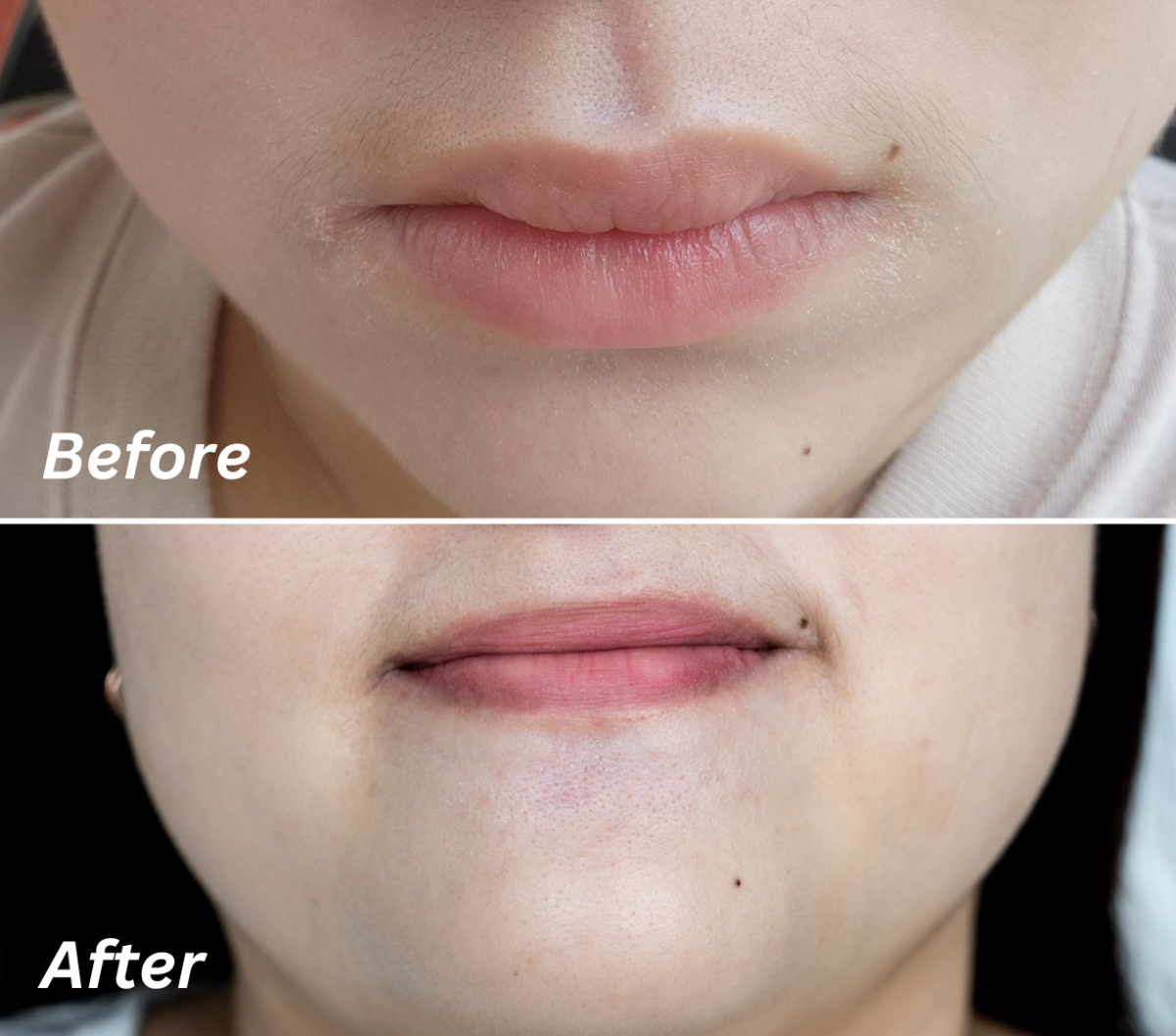 Heather's skin before and after two weeks of testing.