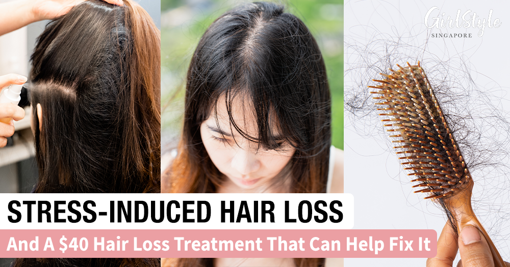 Stress Made My Hair Fall Out, And Here's The 40 Topp Care Hair Loss