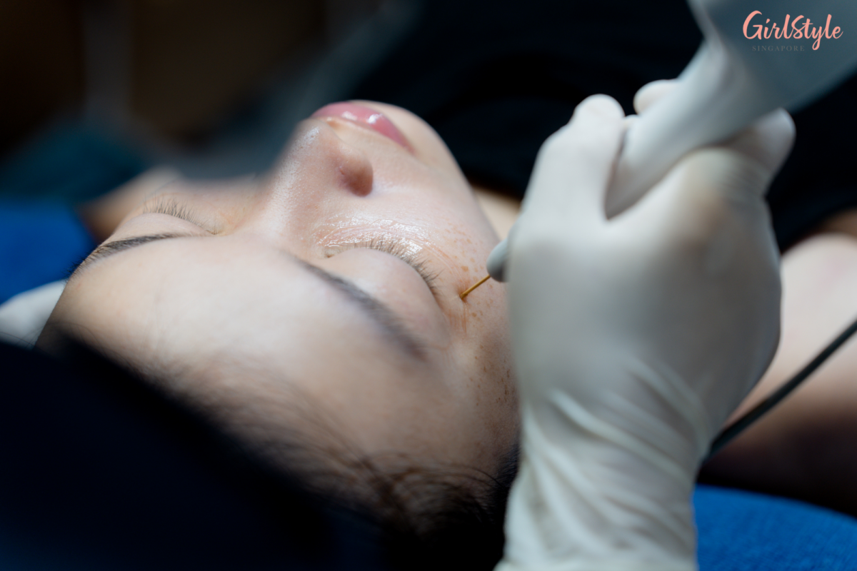 The beautician targets my problem areas with a spot applicator