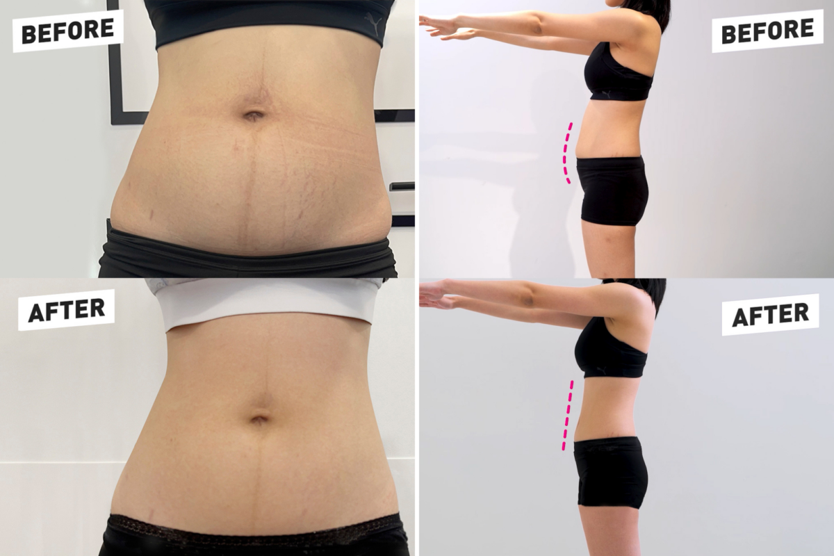 Kimberly Chia's figure before and after the Ultimate Slimming Challenge