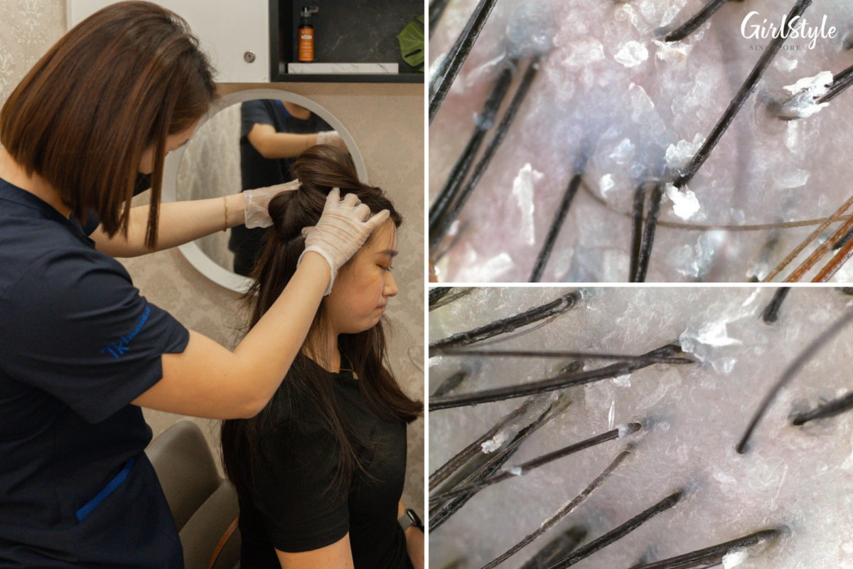The condition of Kristy’s scalp is revealed via the Tricho-scan, which has a magnification of up to 200x