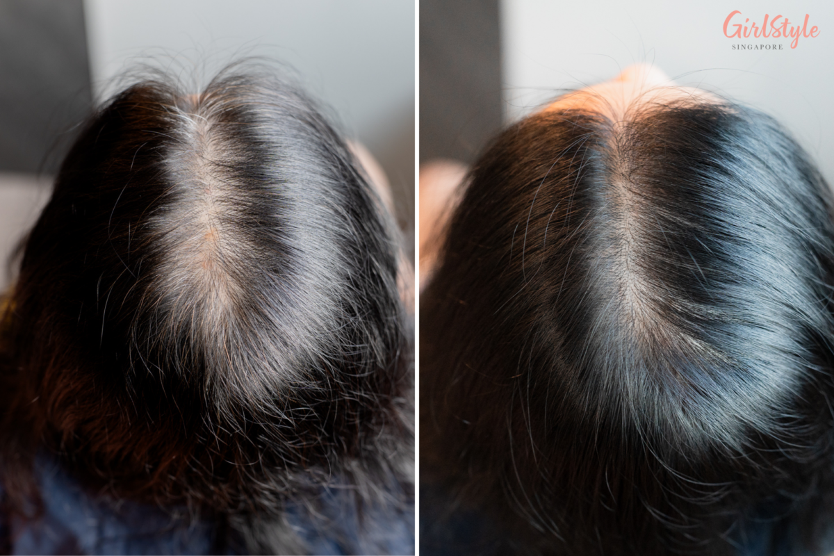 Before and after using Salon de Pro’s hair dye in the shade Deep Brown (7)
