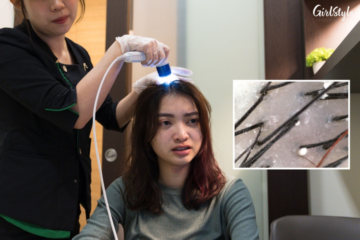I was appalled by the condition of my scalp, which was revealed with a quick scan
