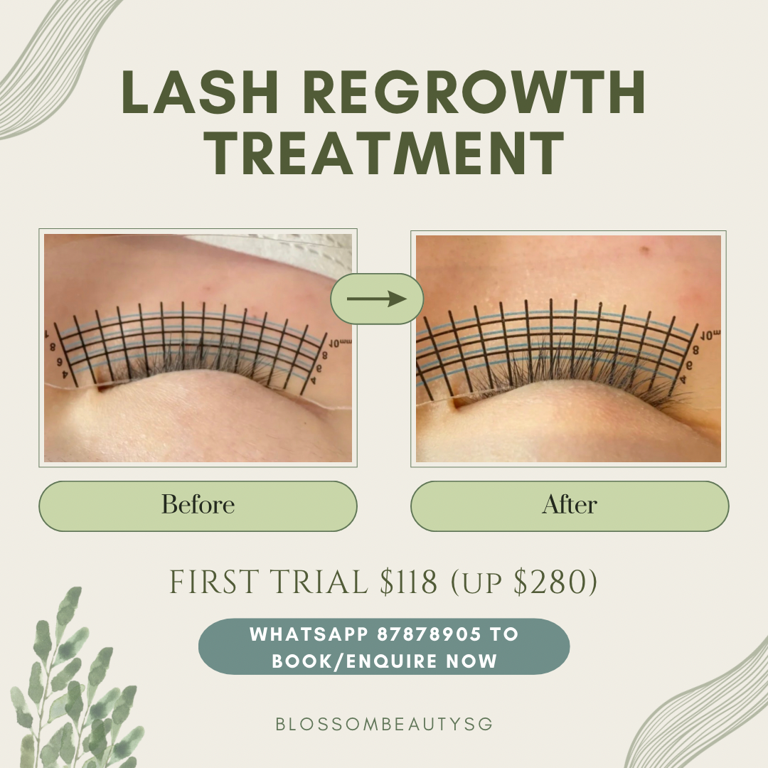Lash Regrowth Treatment