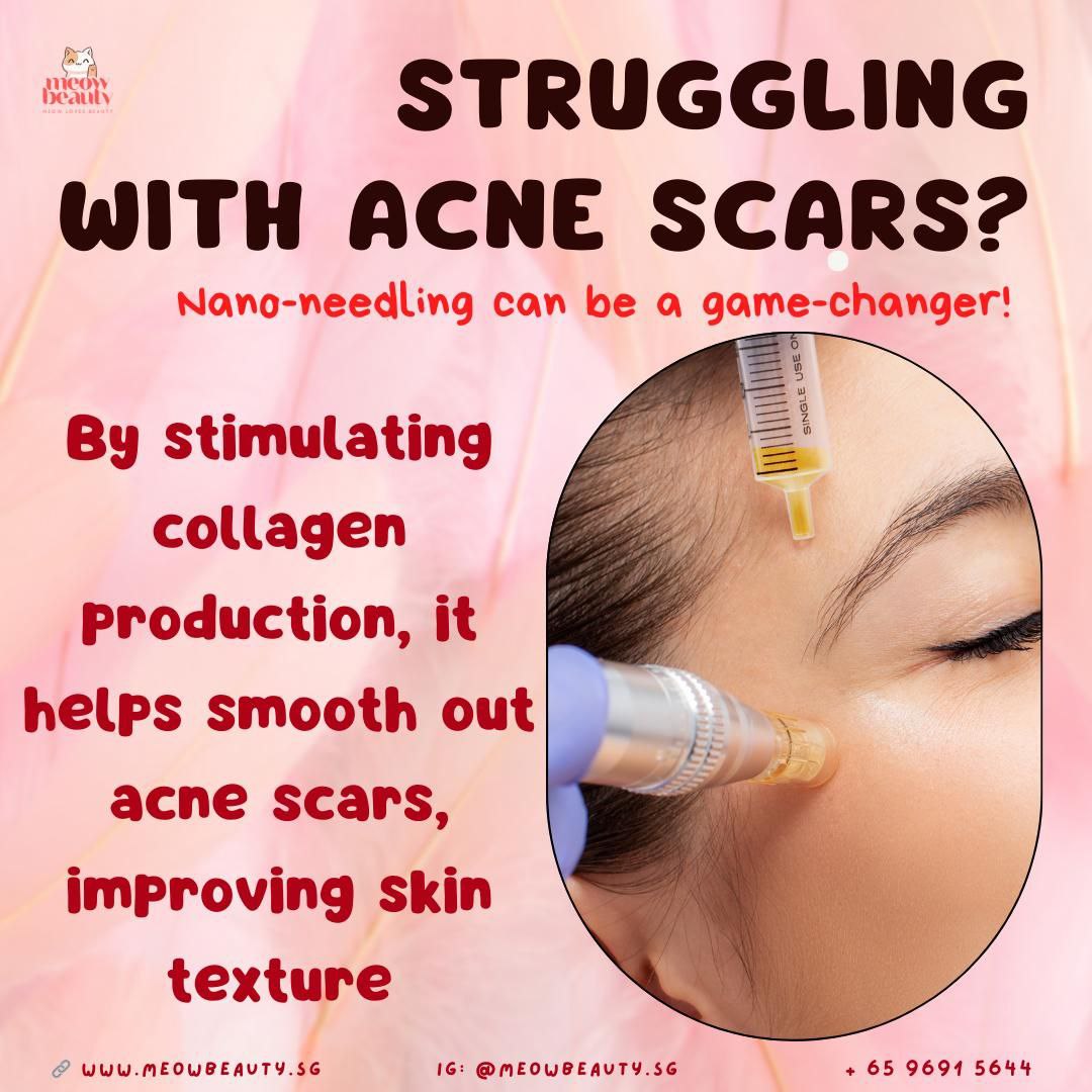 Classic and Nano Needling Facials