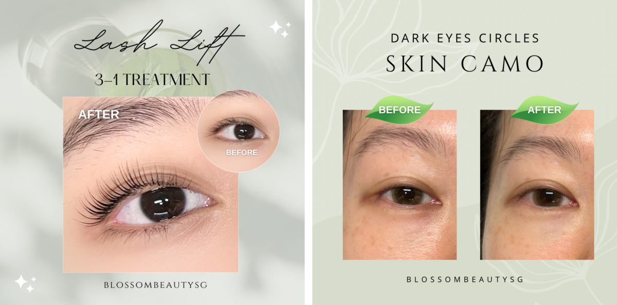 Lash Regrowth Treatment and Dark Eyes Skin Camouflage Treatment