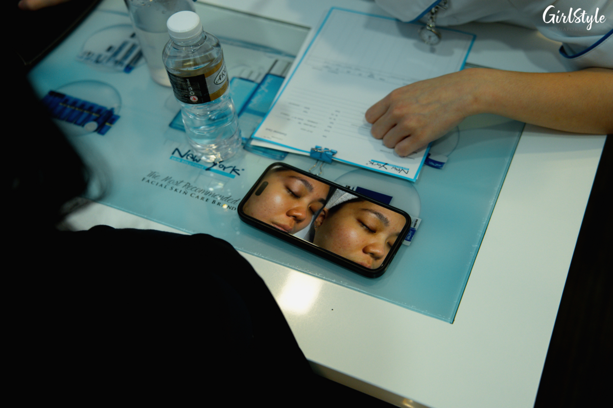 Before and after Cica Acne Treatment at New York Skin Solutions