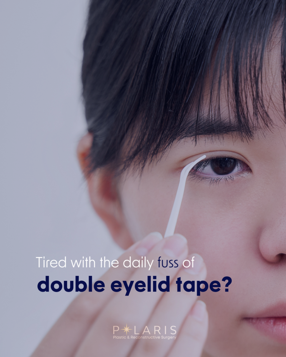Pros and cons of double eyelid surgery