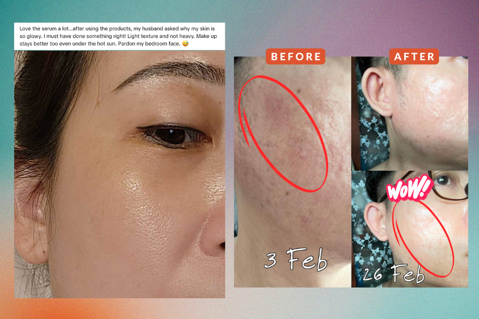 Before & after using Alluora skincare
